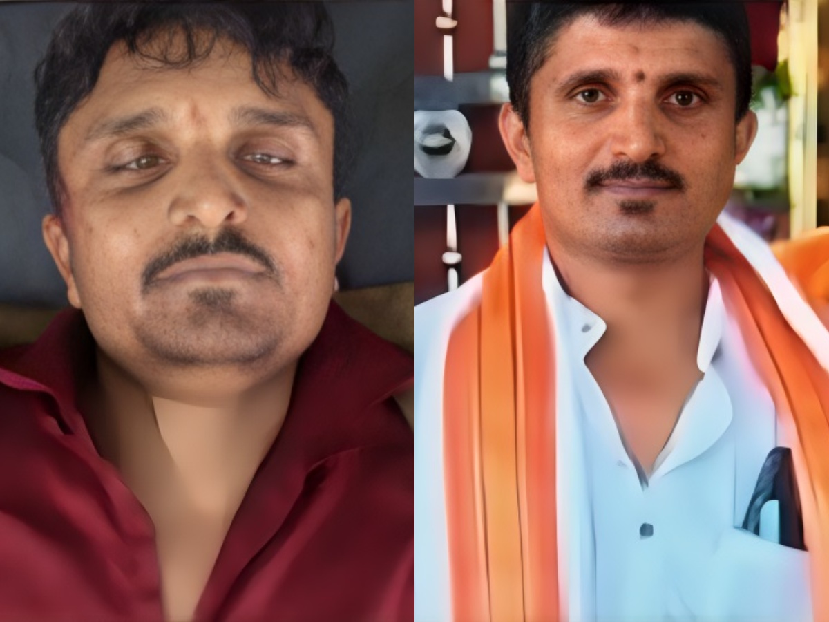 ಬೆಳ್ತಂಗಡಿ: ನಾಯಿ ಅಡ್ಡಬಂದು ಆಟೋ ಪಲ್ಟಿ – ಚಾಲಕ ದುರ್ಮರಣ